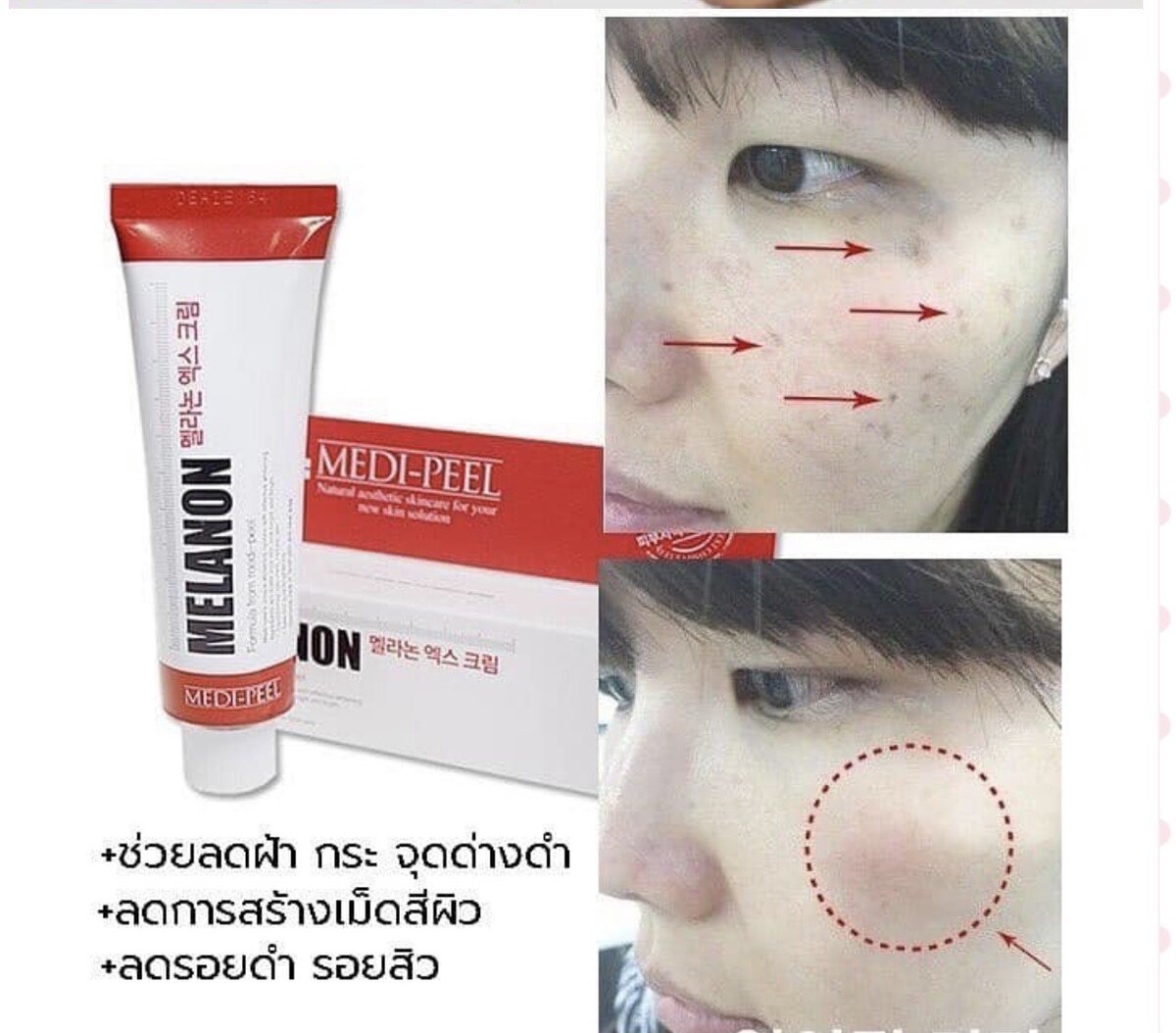 Қыздар мен таяғы бар порно видео