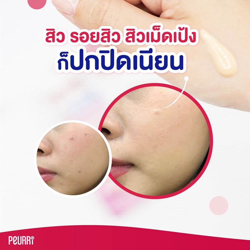 [Free Gift] Peurri Cover All Acne Concealer 3g