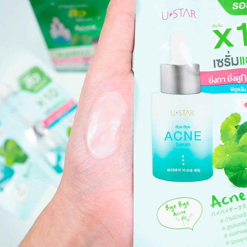 U-Star Bye Bye Acne Serum 5g