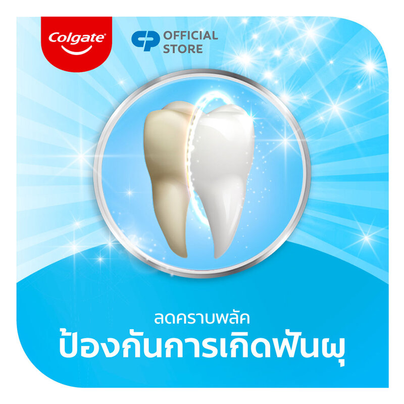 Colgate Advance Whitening Toothpaste 135g