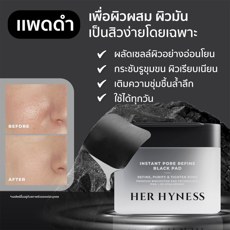 HER HYNESS Instant Pore Refine Black Pad 80 Sheets